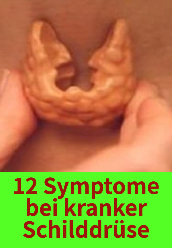 Diese 12 Anzeichen deuten auf Schilddrüsenunterfunktion u. Ä. hin