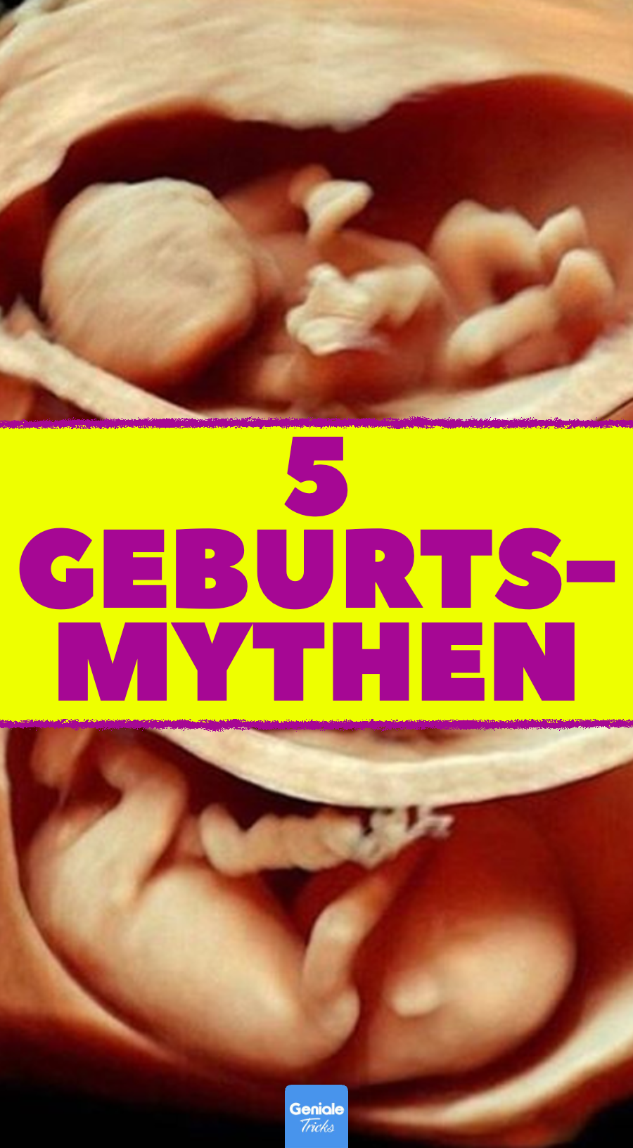 Geburt: 5 Mythen, die nicht (ganz) stimmen